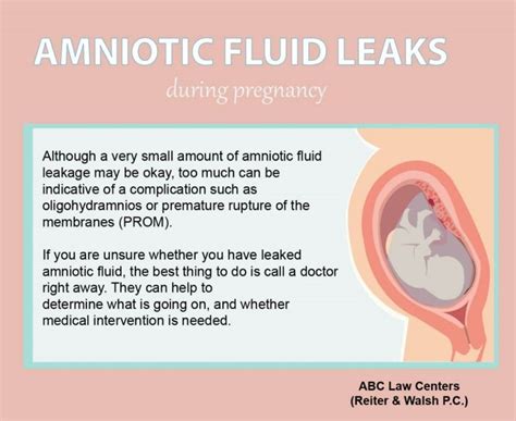 symptoms of leaking amniotic fluid|Signs Of Leaking Amniotic Fluid Vs. Discharge: The。